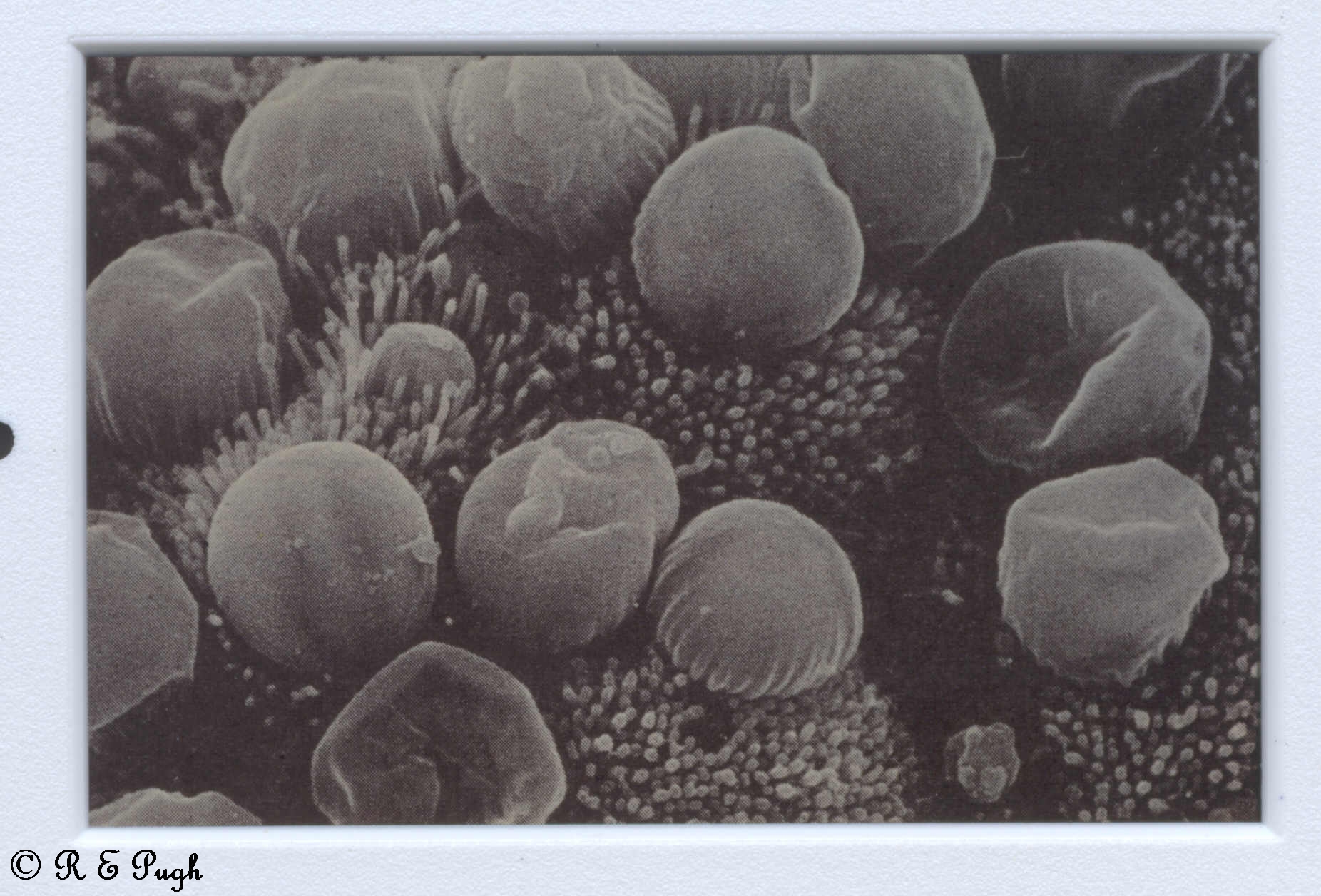 Cryptosporidium parvum 1 06.jpg