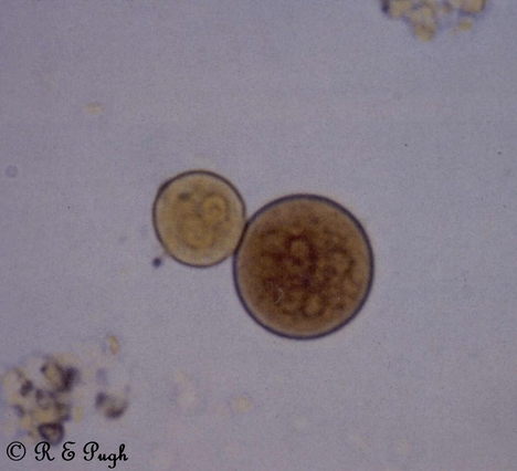 Entamoeba coli в кале. Цисты Entamoeba. Цисты лямблий микроскопия. Цисты лямблий в Кале под микроскопом. Цисты лямблий под микроскопом.